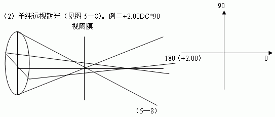 檢影驗光三